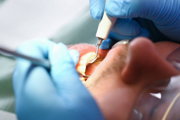 Best Emergency Tooth Extraction in Sewell, NJ